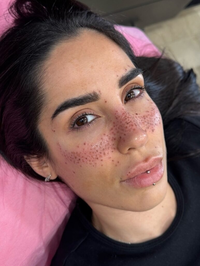 Bold Clustered Freckles Tattoo with High Coverage Tattoo Design
