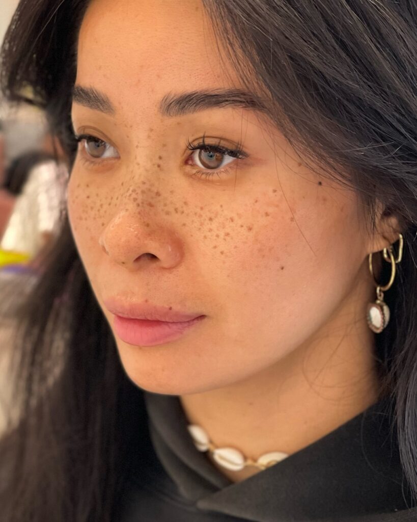 Dense Natural Freckles Tattoo with Realistic Depth Tattoo Design
