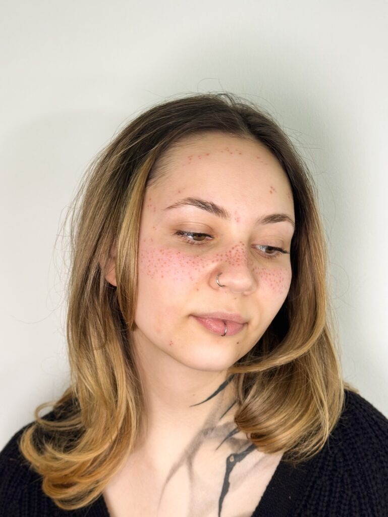 Fresh Subtle Freckles Tattoo with Soft Healing Effect Tattoo Design