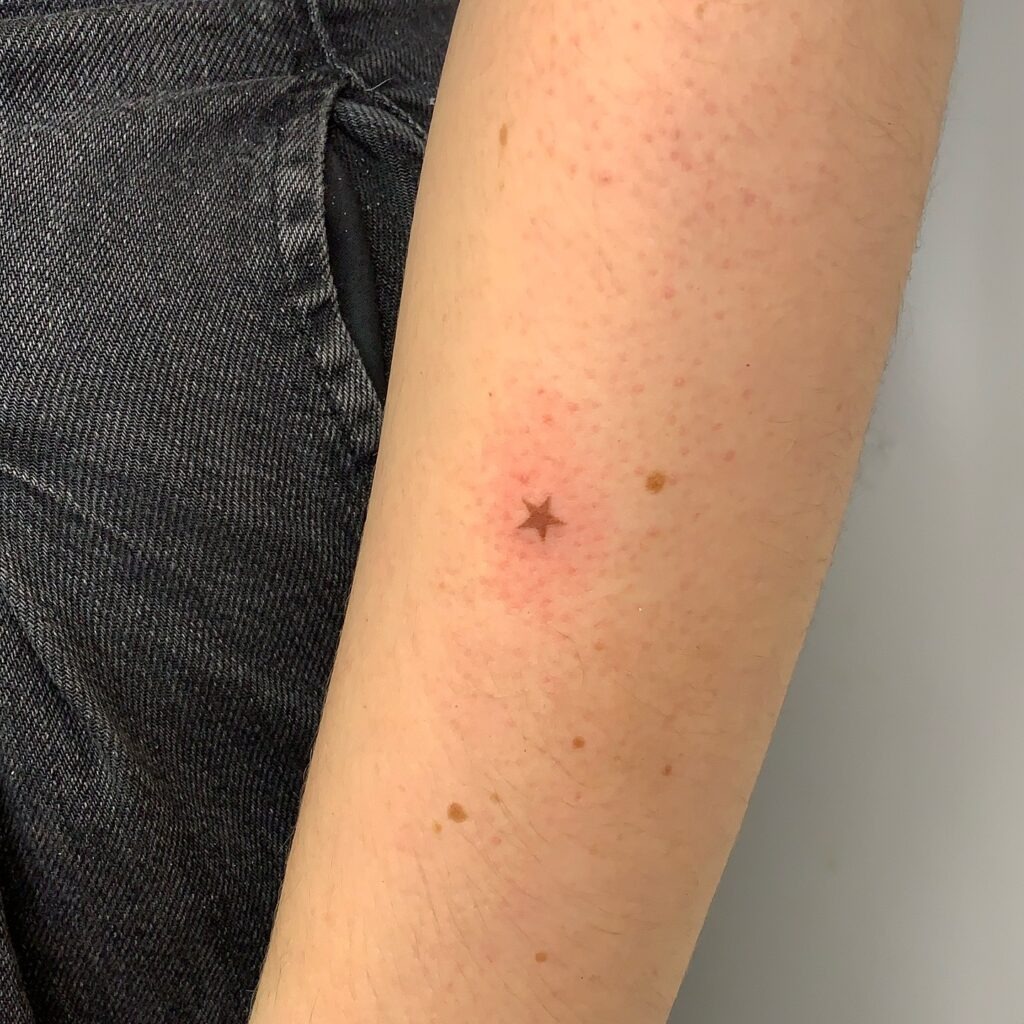 Full Coverage Freckles Tattoo with Natural Density Tattoo Design