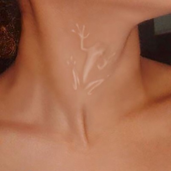 A Cleverly Camouflaged Tree Frog Tattoo Design