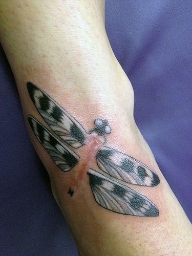 Dragonfly Over Scar Tattoo Tattoo Design