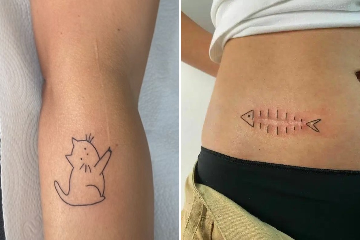 23 Powerful Scar Tattoo Ideas To Embrace Your Healing Journey Featured Lookbook Collage